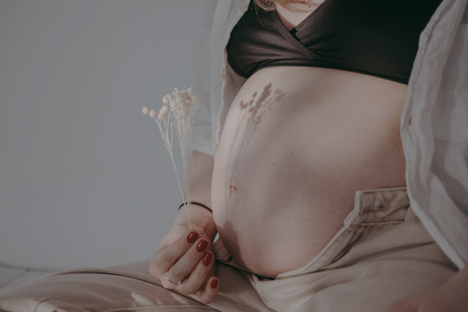 妊娠紋出現的前兆為何？